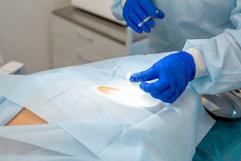 Surgeon performing Mohs surgery to remove skin cancer